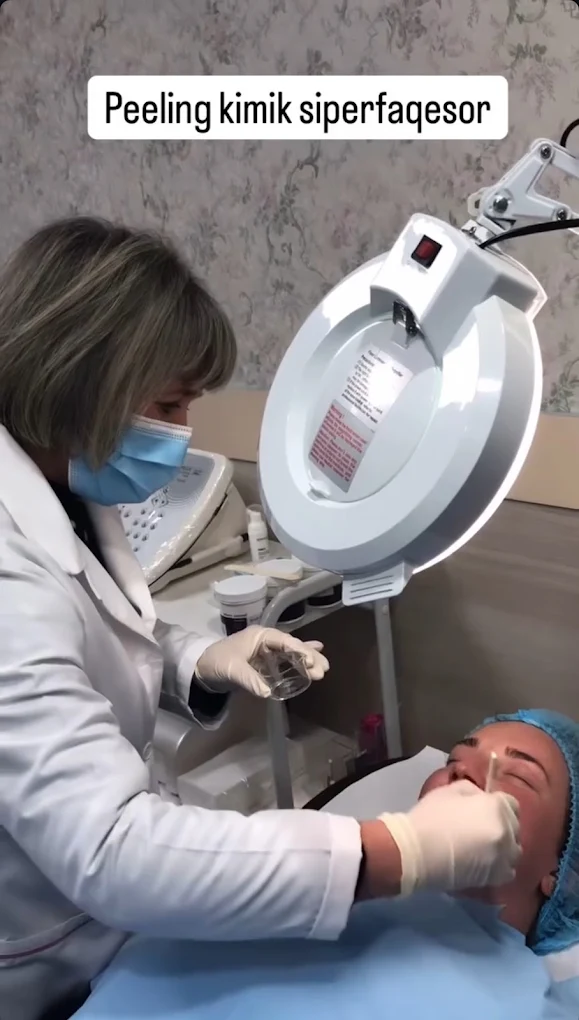 Peeling Kimik
