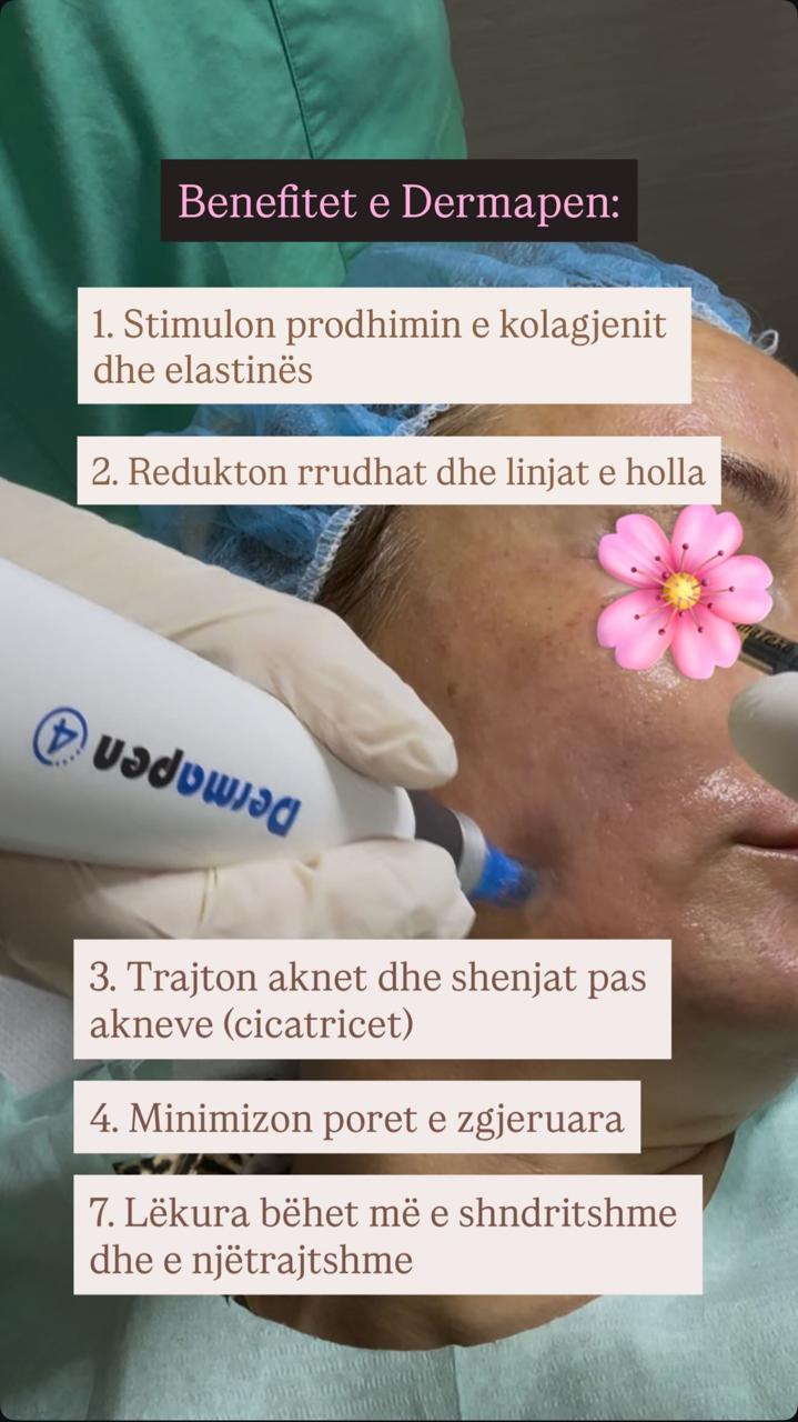 Dermapen — Benefitet