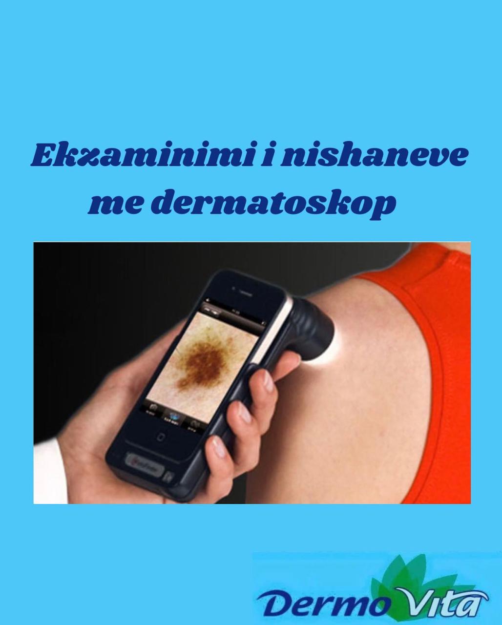 Ekzaminim me Dermatoskop
