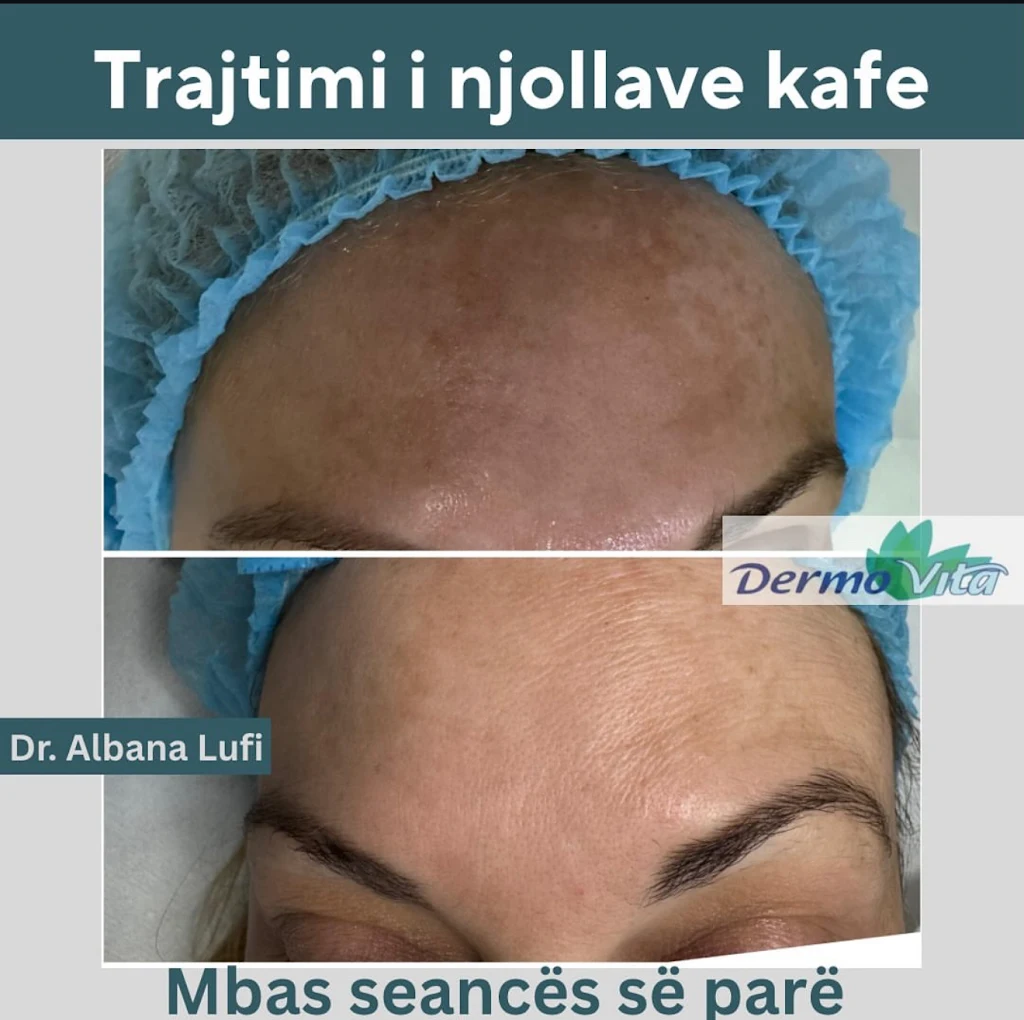 Njolla Kafe